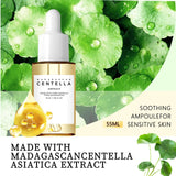 Sensitive Skin Comfort Serum 55ml - Madagascar Centella Formula Calms, Soothes & Deeply Moisturizes for Daily Skin Care Support. Beto Beauty