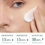 SADOER Tea Tree Acne Removing Face Cream Anti Acne Hydrating Oil Control Moisturizing Facial Creams Face Skin Care Products Beto Beauty