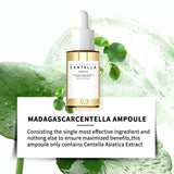 Sensitive Skin Comfort Serum 55ml - Madagascar Centella Formula Calms, Soothes & Deeply Moisturizes for Daily Skin Care Support. Beto Beauty