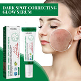 Dark Spot Correcting Glow Serum Fade Pigment Freckle Melasma Melanin Improves Dull Skin Facial Whitening Brightening Essence Beto Beauty