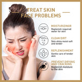 EELHOE Rice Toner Shrink Pores Oil Control Glow Skin Barrier Repair Care Niacinamide Deep Hydration Face Brightening Serum 150ml Beto Beauty