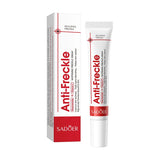 1/3/5pcs SADOER Anti Freckle Cream Face Whitening Creams Spot Removing Anti-aging Moisturizing Freckles Removal Facial Cream Beto Beauty