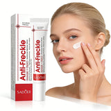 SADOER Anti Freckle Cream Face Whitening Creams Spot Removing Anti-aging Moisturizing Freckles Removal Facial Cream Skin Care Beto Beauty