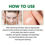 Dark Spot Correcting Glow Serum Fade Pigment Freckle Melasma Melanin Improves Dull Skin Facial Whitening Brightening Essence Beto Beauty
