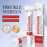 SADOER Anti Freckle Cream Face Whitening Creams Spot Removing Anti-aging Moisturizing Freckles Removal Facial Cream Skin Care Beto Beauty