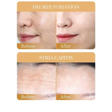 10pcs SADOER Collagen Anti Wrinkle Face Mask Moisturizing Anti Aging Repair Brightening Facial Masks Skin Care Beto Beauty