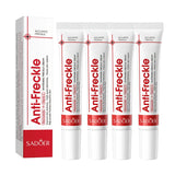 SADOER Anti Freckle Cream Face Whitening Creams Spot Removing Anti-aging Moisturizing Freckles Removal Facial Cream Skin Care Beto Beauty