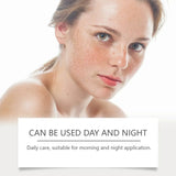 SADOER Anti Freckle Cream Face Whitening Creams Spot Removing Anti-aging Moisturizing Freckles Removal Facial Cream Skin Care Beto Beauty