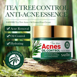 SADOER Tea Tree Acne Removing Face Cream Anti Acne Hydrating Oil Control Moisturizing Facial Creams Face Skin Care Products Beto Beauty