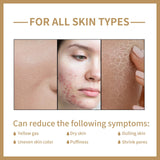 EELHOE Rice Toner Shrink Pores Oil Control Glow Skin Barrier Repair Care Niacinamide Deep Hydration Face Brightening Serum 150ml Beto Beauty