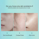 10pcs Hyaluronic Acid Hydrating Facial Mask Sheet Masks for Face Hydrating Shrinking Pores Moisturizing Face Masks Skin Care Beto Beauty